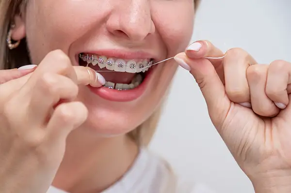 A close-up of a woman using dental floss to clean between her teeth with braces, highlighting the importance of oral hygiene.