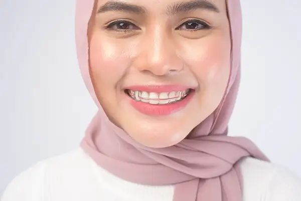 Smiling woman wearing a discreet wire retainer to protect the alignment of her perfect teeth.